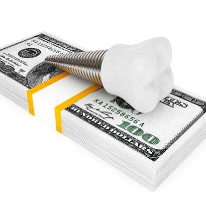 Dental implant sitting on a pile of money